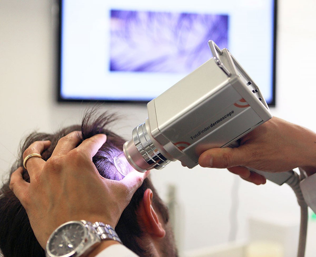 Fotofinder - tecnologia de ponta para avaliar digitalmente a queda de cabelo