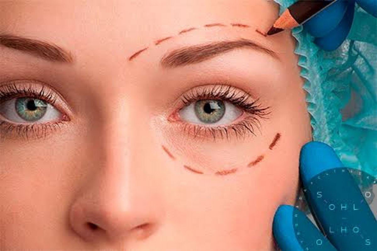 Plástica Ocular: saiba mais sobre esta importante subespecialidade da Oftalmologia  