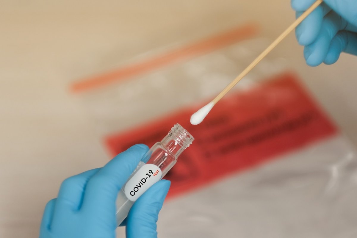 Laboratórios alertam para ameaça de desabastecimento de insumos para testes de Covi d-19