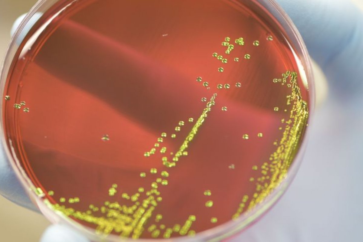 Infecções por superbactérias levaram 1,2 milhão de pessoas à morte em 2019
