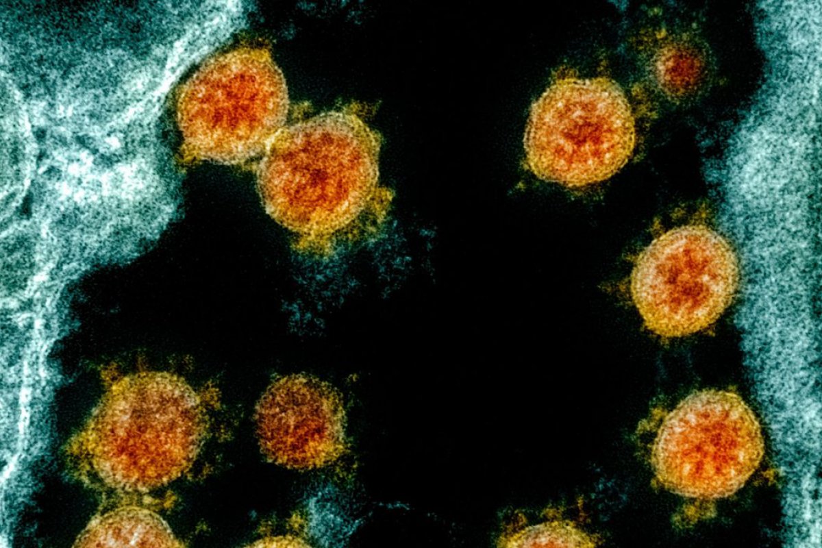 Segundo o Imperial College, taxa de transmissão do coronavírus cai para 1,69 no Brasil