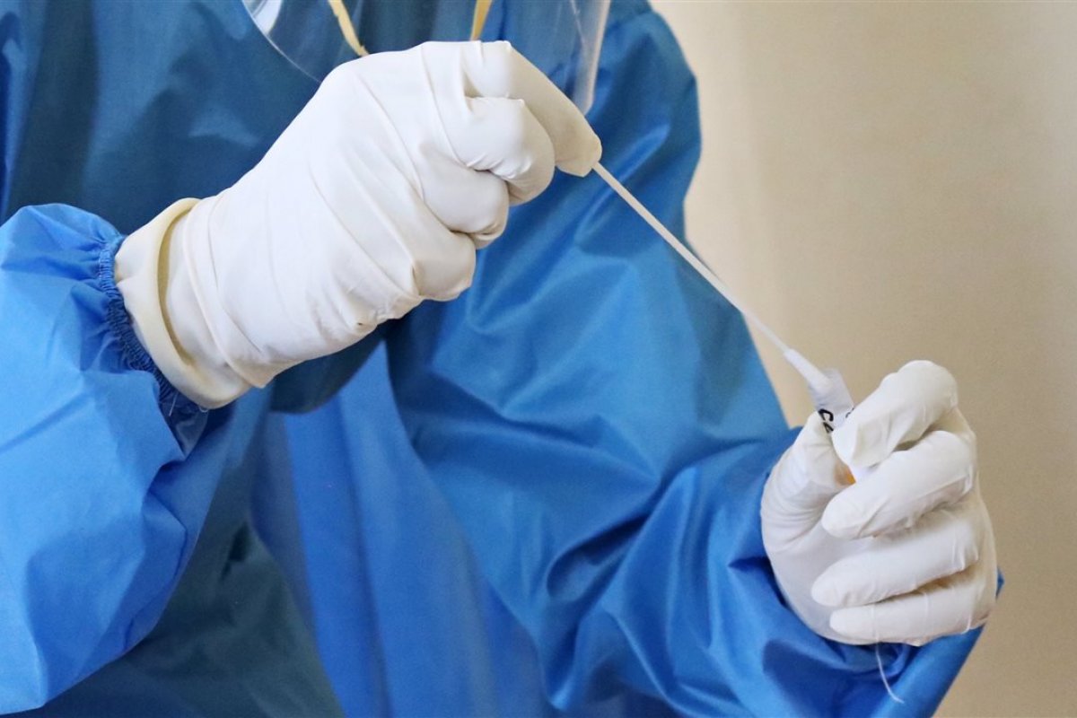 Covid-19: janeiro teve a 4ª menor distribuição de testes durante a pandemia 