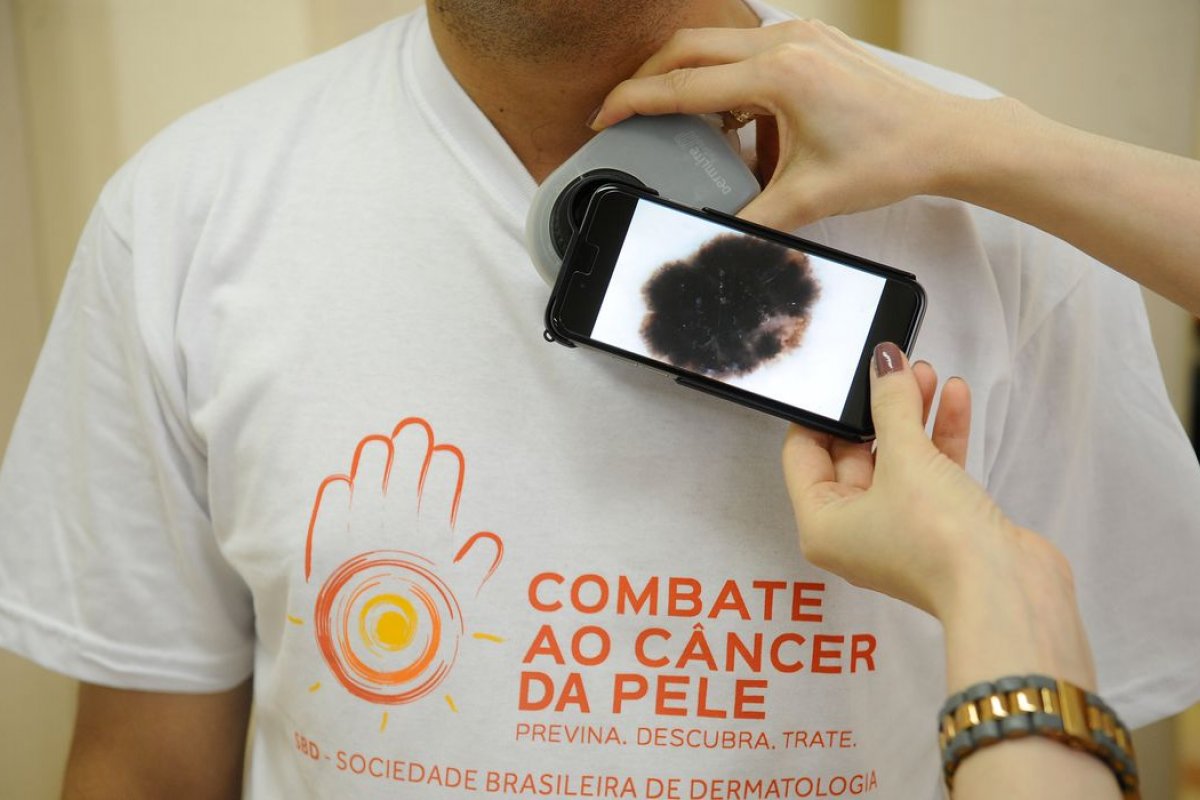 Guia procura esclarecer relação entre Covid-19 e lesões de pele