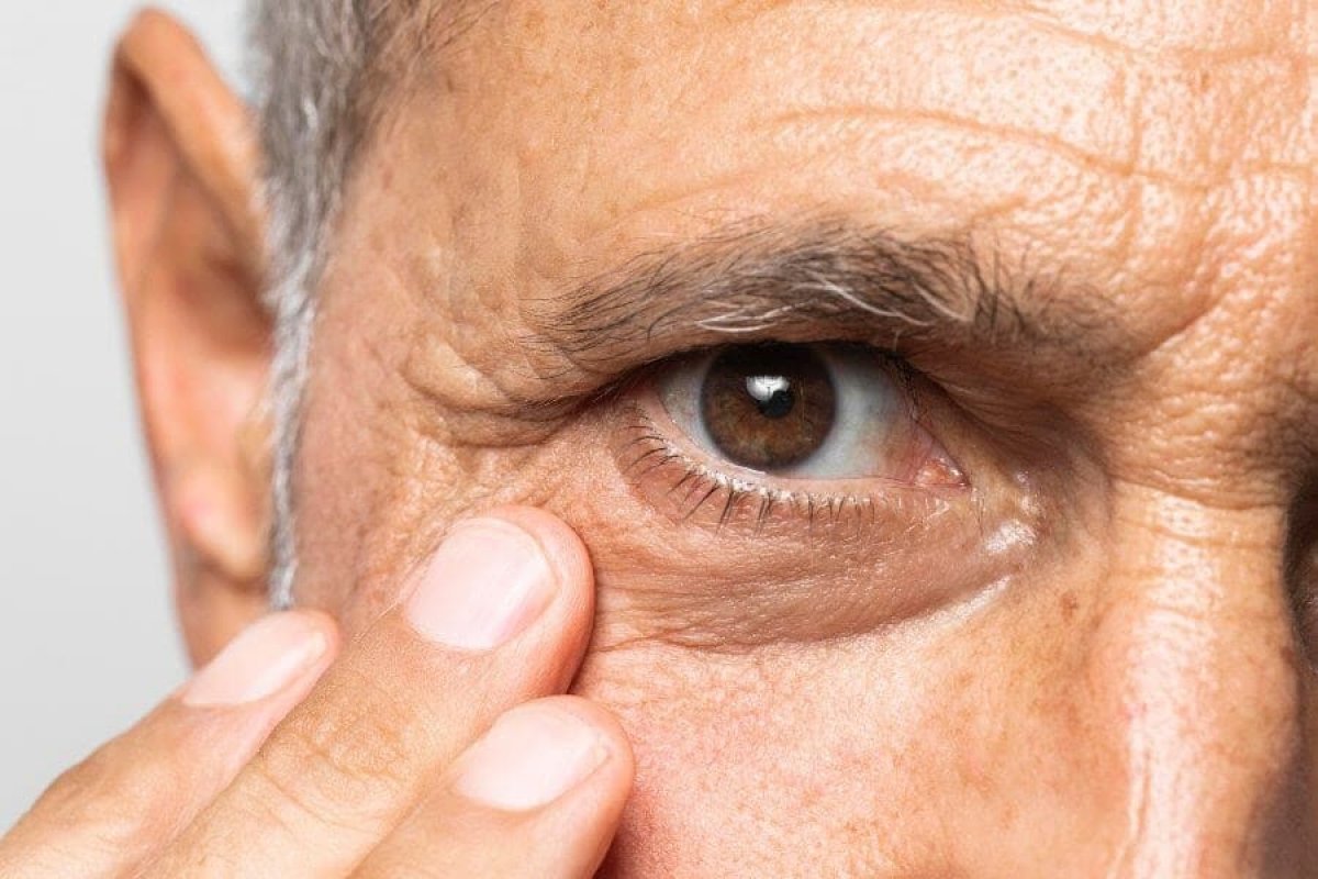 Silencioso e sem cura, glaucoma atinge mais de 900 mil brasileiros e pode causar cegueira irreversível  