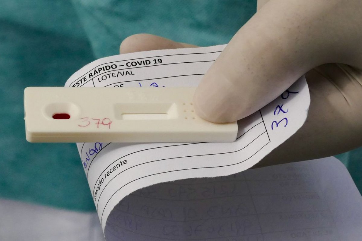Pesquisa aponta subnotificações de casos de Covid-19 em 2020