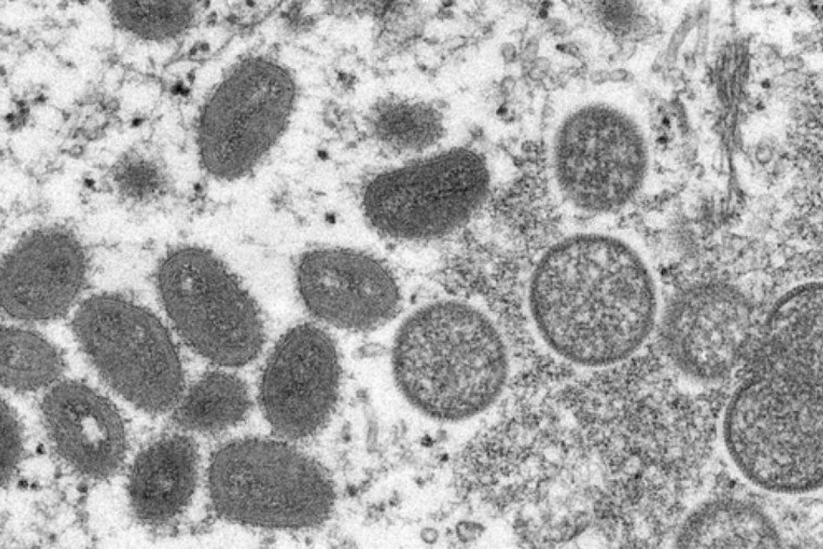 Varíola dos macacos: cientistas brasileiros veem risco da doença chegar ao país 