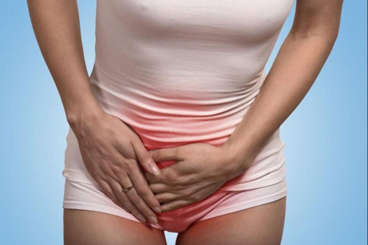Varizes pélvicas: causa de dor crônica em mulheres  