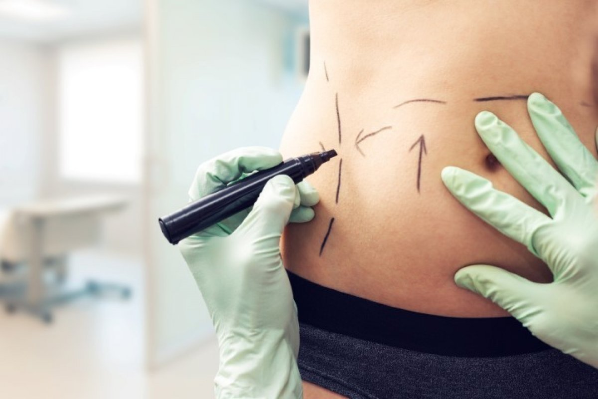 Fique por dentro as cirurgias plásticas mais procuradas nas estações mais frias!