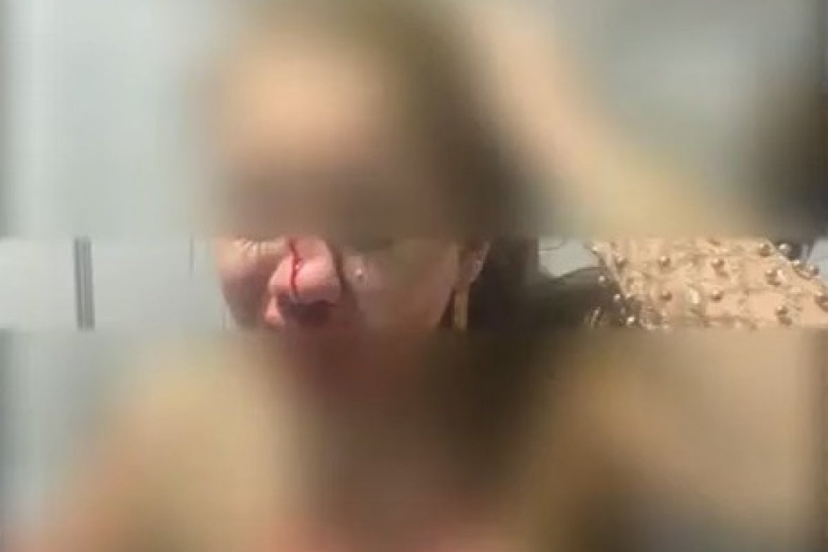 Mulher é agredida após se recusar a dançar forró com homem em festa de Itabaiana