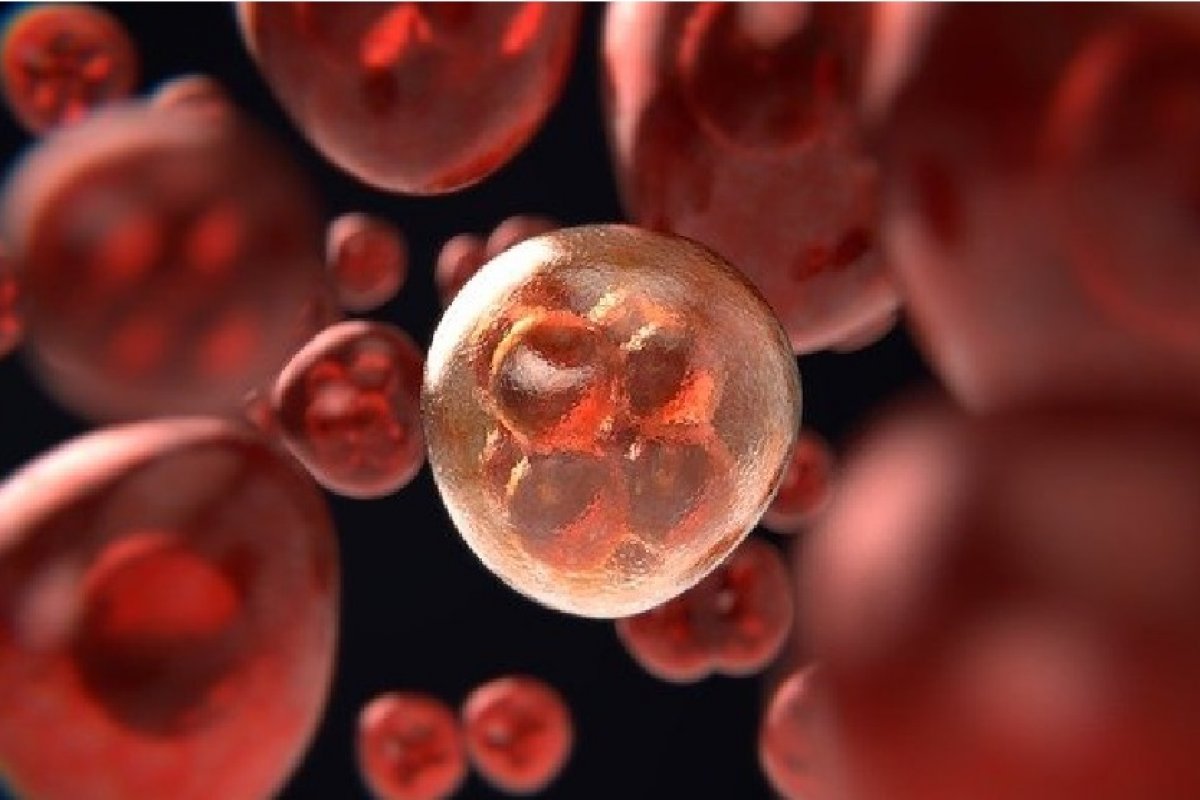 Cientistas descobrem mecanismo biológico que liga câncer de mama e diabetes