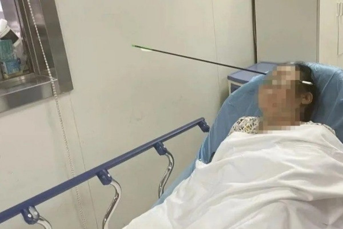 Mulher é atingida na cabeça por flecha de 60 cm 