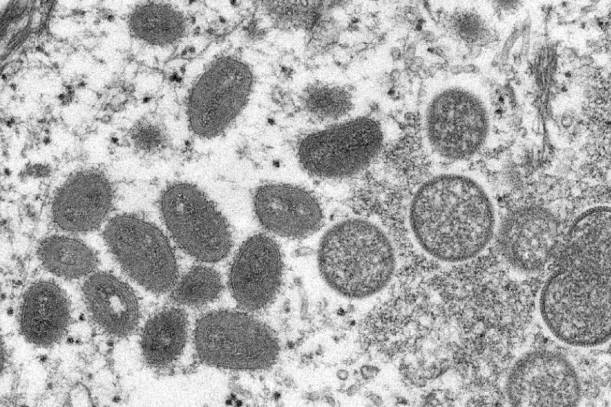Monkeypox: Fiocruz conclui sequenciamento genético de vírus detectado no Rio de Janeiro 