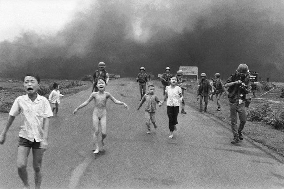Depois de 50 anos, 'Garota Napalm' passa por último tratamento de pele
