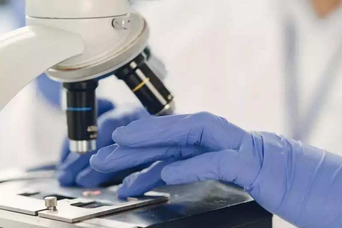 Laboratórios privados no Rio e em SP começam a realizar testes para a varíola dos macacos
