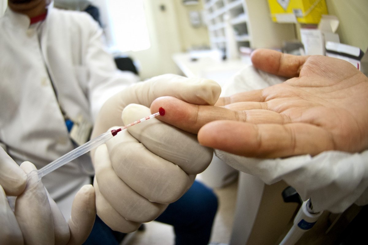 Após 20 anos, cientistas descobrem novo subtipo de HIV
