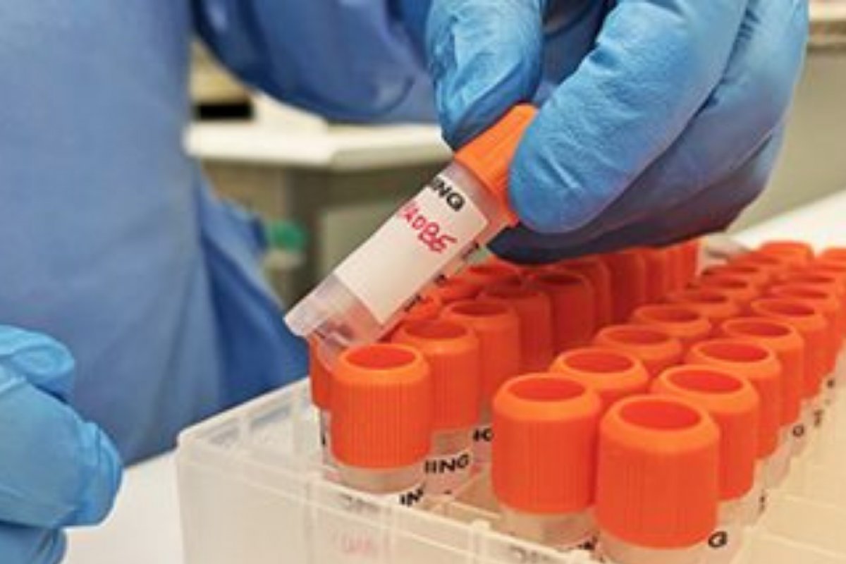 Novo caso de Monkeypox é confirmado na Bahia