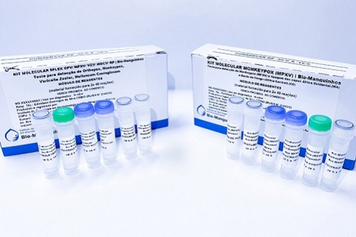 Fiocruz solicita à Anvisa registro de dois kits para detecção de varíola dos macacos