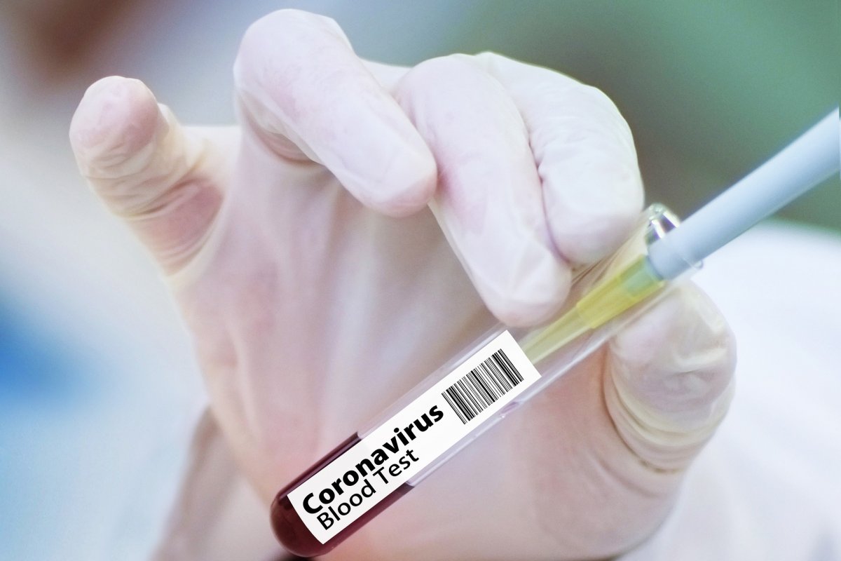 Brasil registra 6,2 mil novos casos e 122 óbitos por Covid-19 nas últimas 24h