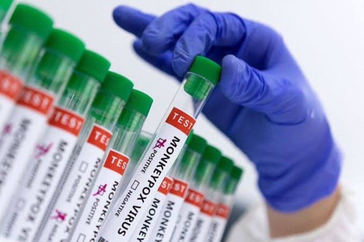 Brasil registra a segunda morte por Varíola dos Macacos