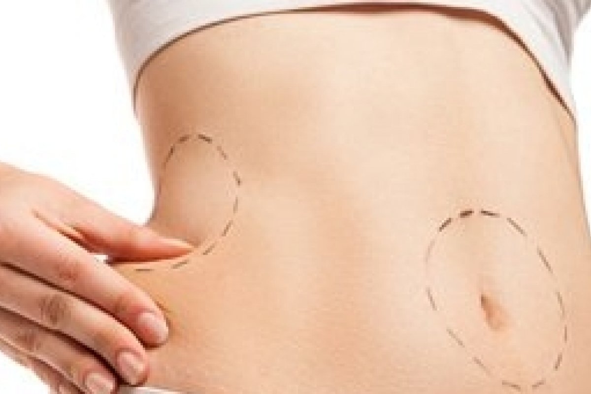 Cresce o número de adolescentes em busca de cirurgia plástica 