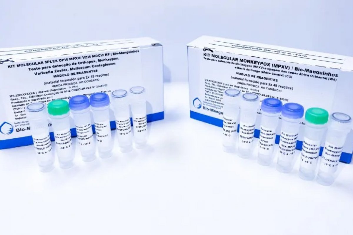  Anvisa aprova registro de primeiro teste para diagnóstico da varíola dos macacos no Brasil