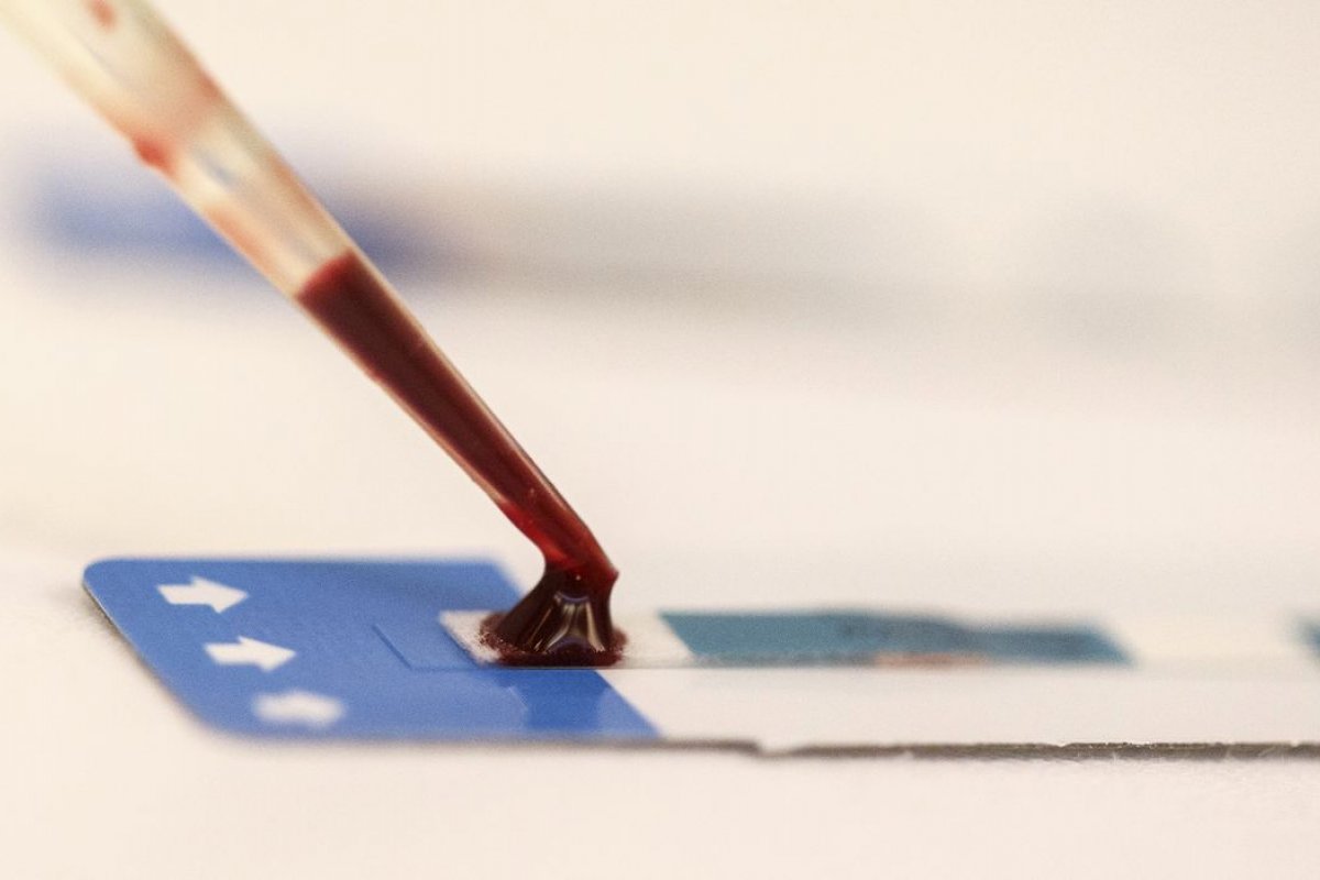 Pesquisadores testam  novo tratamento para combater o vírus do HIV 