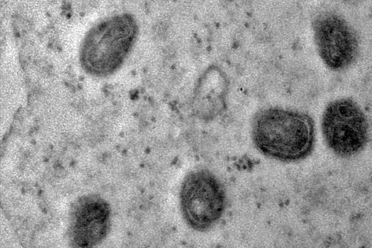 OMS mantém varíola dos macacos como emergência de preocupação internacional