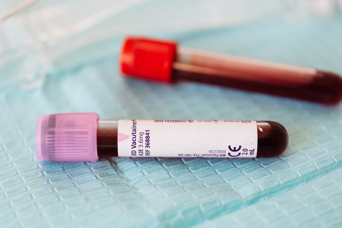 Estudo afirma que análise de sangue e urina podem detectar câncer em fase inicial