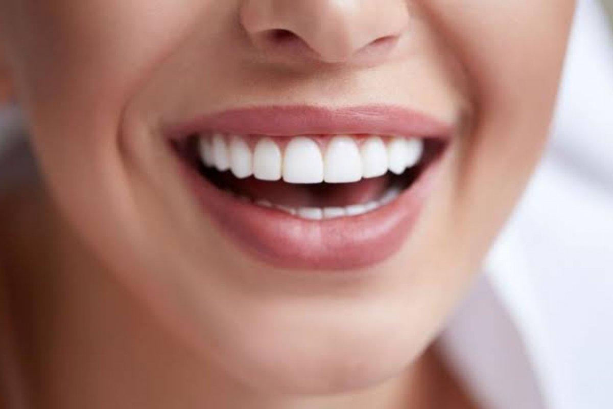  Dentista dá dicas de como deixar o sorriso ainda mais bonito e saudável durante o Verão! 