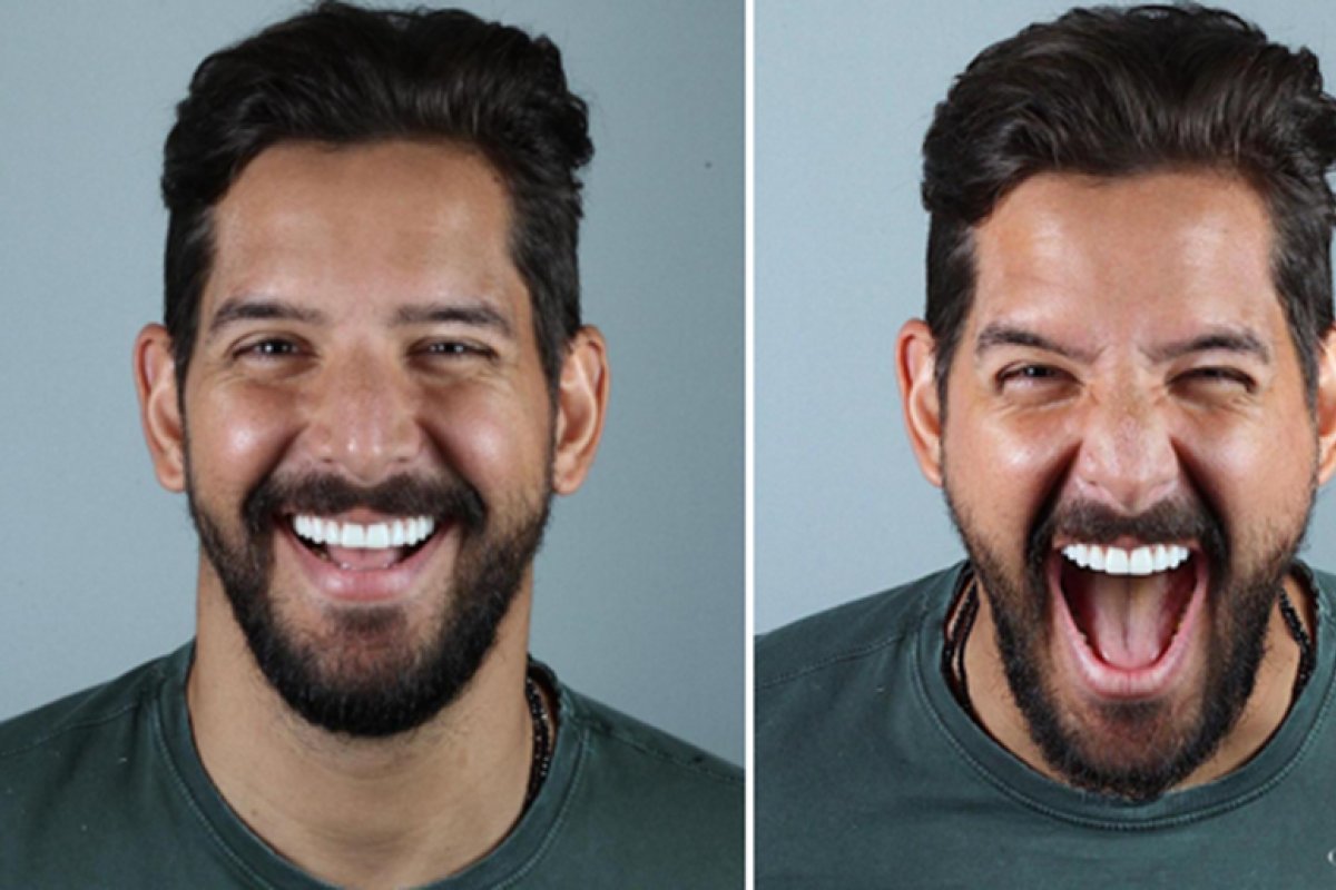 Ateliê prepara o sorriso de Felipe Pezzoni, da Banda EVA, para o Carnaval! 