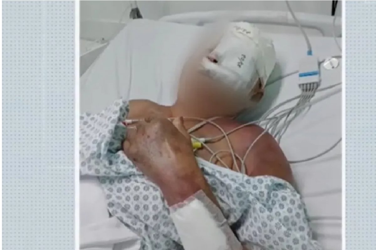 Idosa tem todos os dentes quebrados após ser agredida a pauladas em Camaçari (BA)