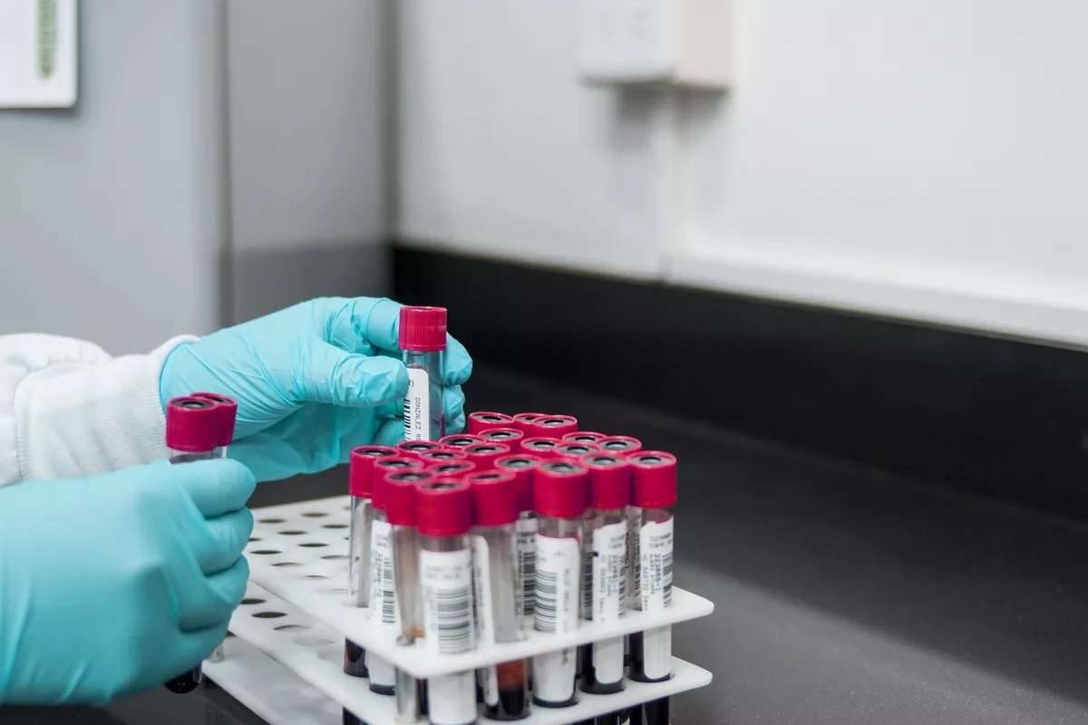 Testagem de gestantes para HTLV-1 poderia evitar infecção de mais de mil bebês por ano