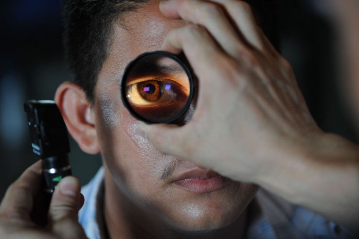 Conselho Brasileiro de Oftalmologia alerta para mito e desinformação sobre glaucoma