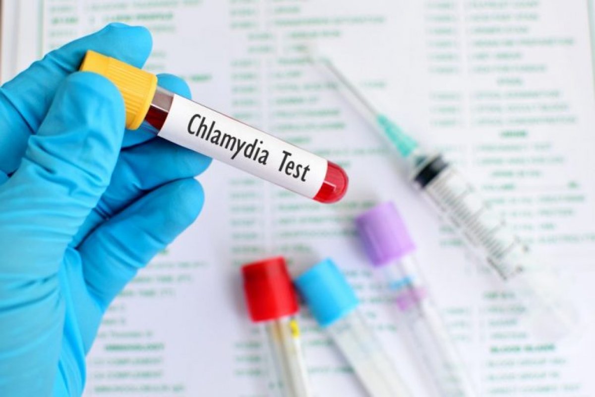 SUS começa a ofertar testes de clamídia e gonorreia de forma definitiva