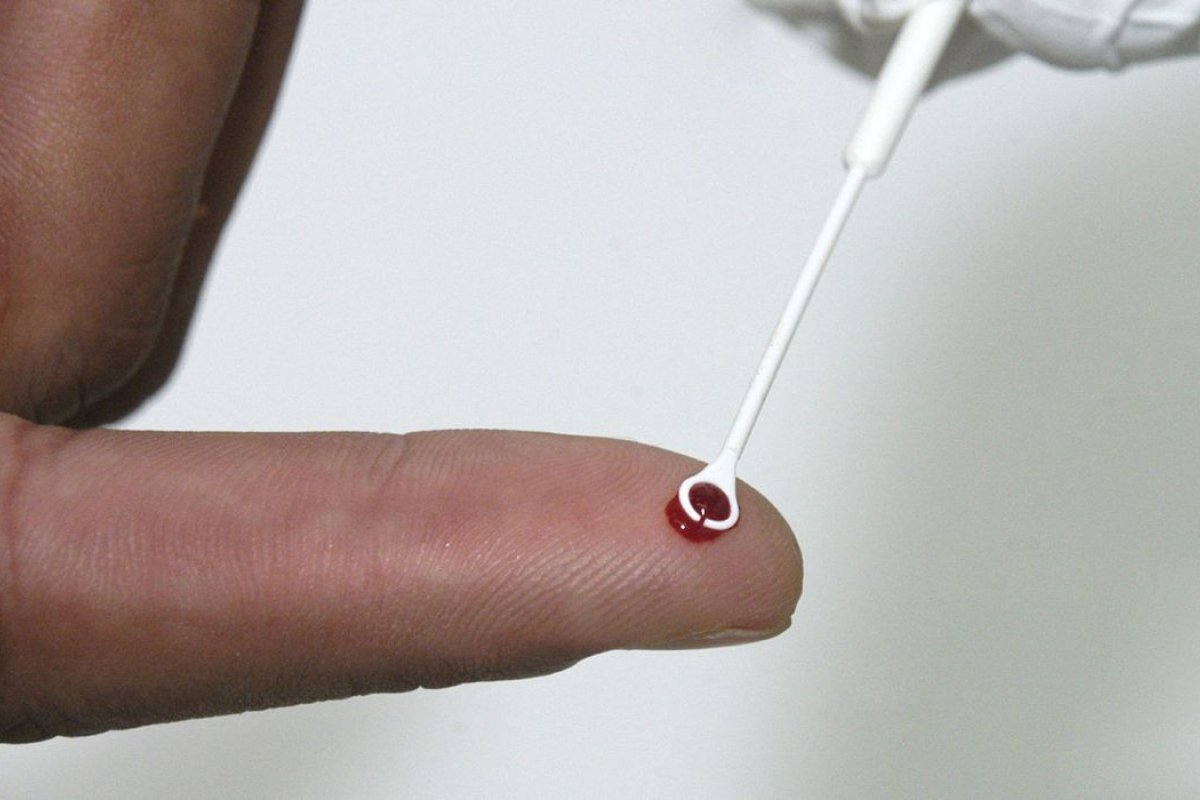 Sexto paciente é declarado curado do HIV após transplante de medula