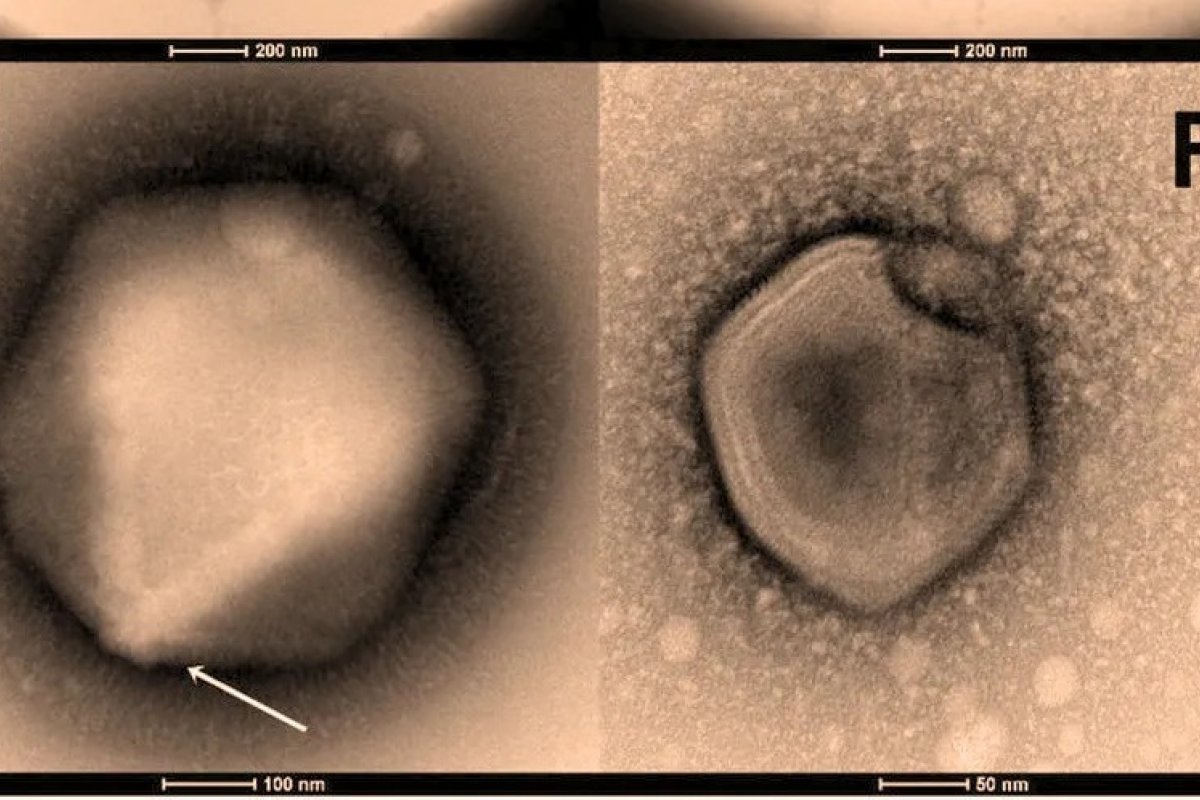 Cientistas estudam vírus adormecidos que podem voltar a infectar humanos 