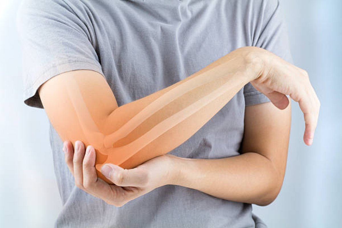 Ministério da Saúde estima que cerca de 10 milhões de pessoas convivem com osteoporose