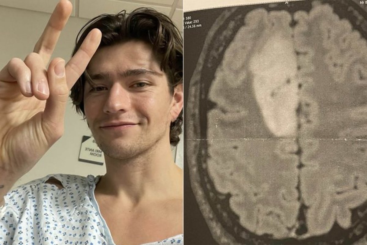Ator da Netflix revela que está com câncer no cérebro! 