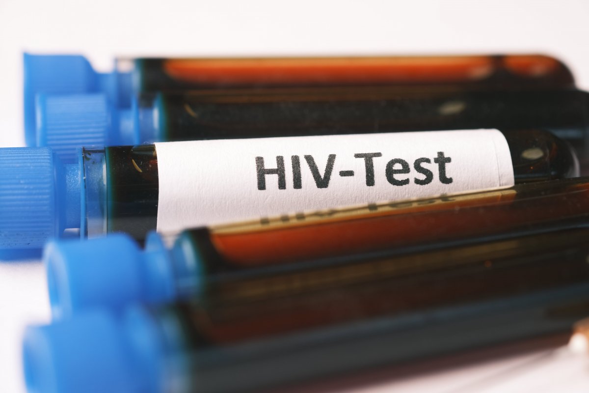 Carga viral durante infecção por HIV determina evolução do vírus