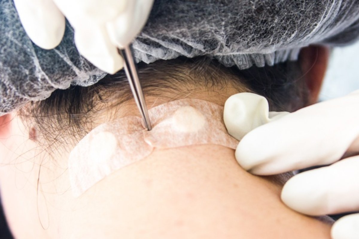 Silício potencializa microfisioterapia com técnica ortomolecular!