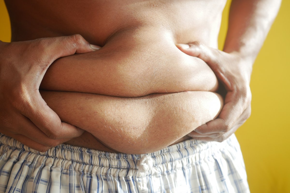 Obesidade atinge 1 bilhão de pessoas no mundo, aponta estudo 