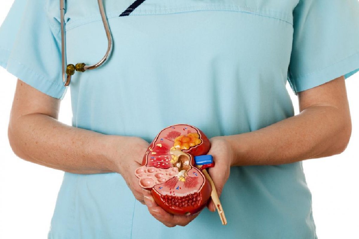 Dia Mundial do Rim: não fazer atividade física e comer alimentos ultraprocessados favorecem o adoecimento dos órgãos 