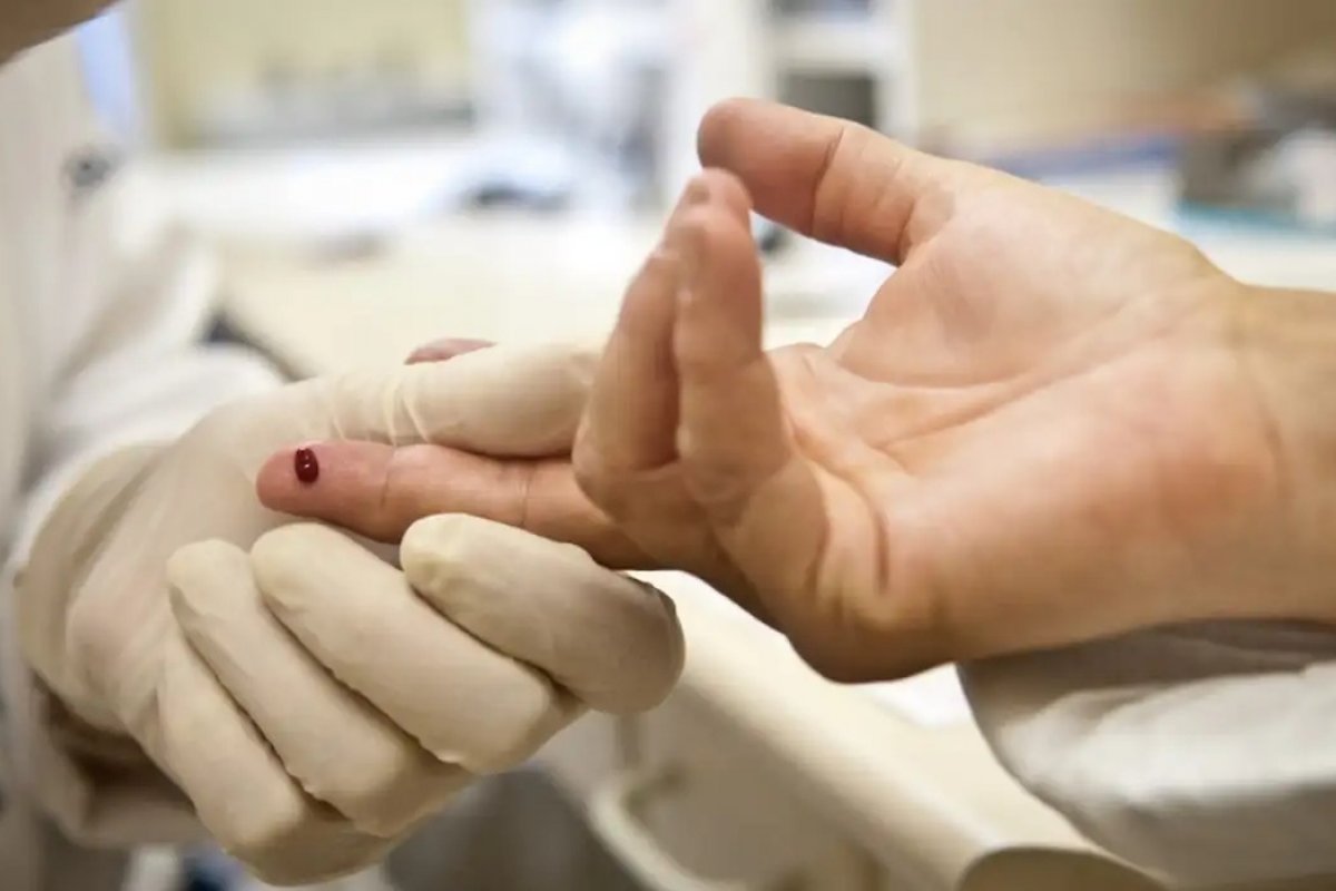 Estudo holandês consegue eliminar vírus HIV de células humanas