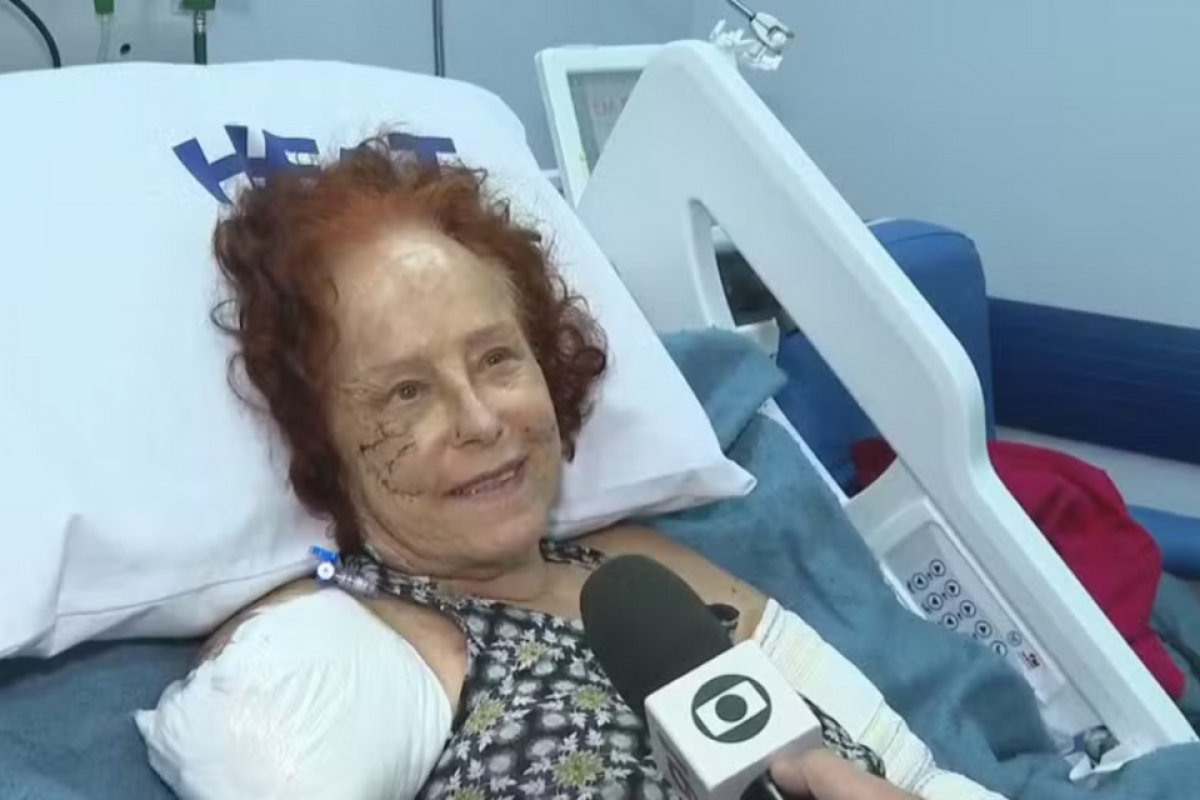  Após ataque de cachorros, Roseana Murray tem alta nesta quinta-feira