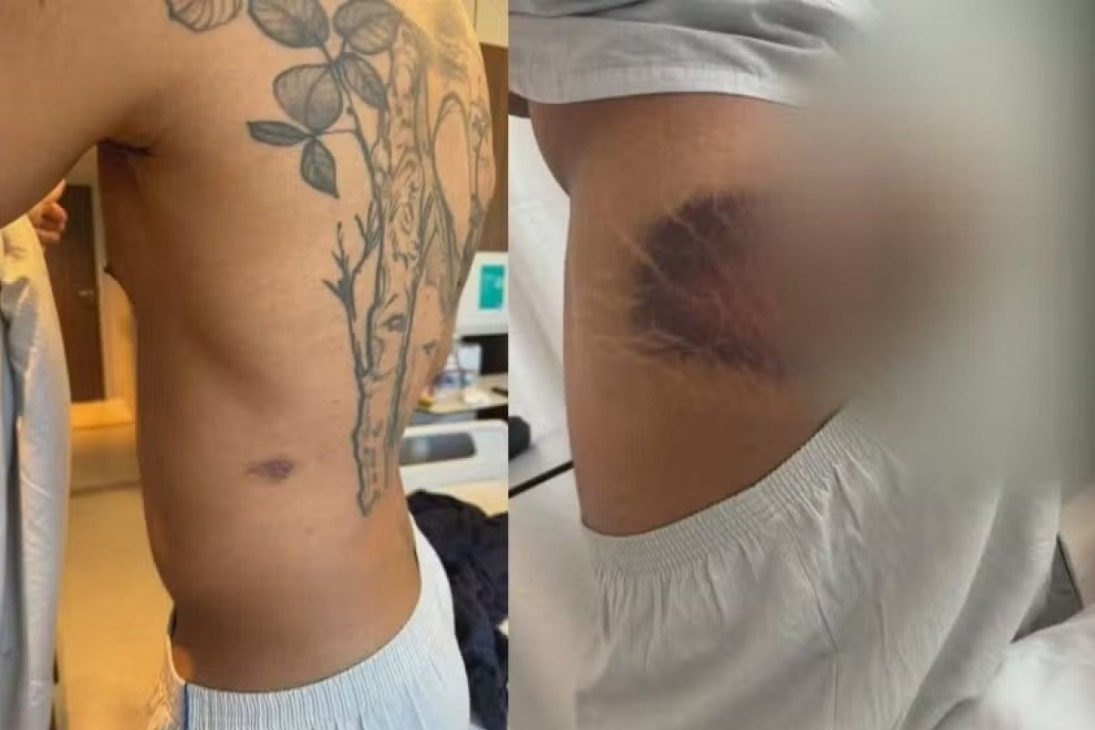 "Criminosos de farda", desabafa soldado que denunciou tortura na PM do Distrito Federal