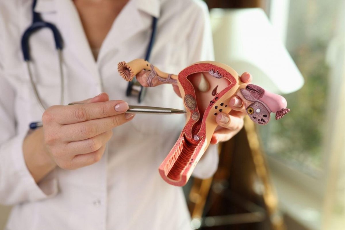 No Dia Internacional da Luta contra Endometriose, ginecologista alerta para sintomas; doença atinge mais de 7 milhões de mulheres no Brasil! 