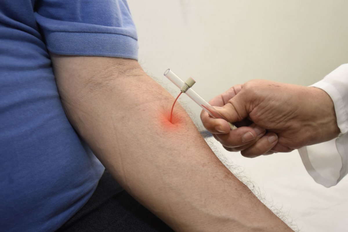 Brasil é o segundo país com mais ocorrências recentes de hanseníase