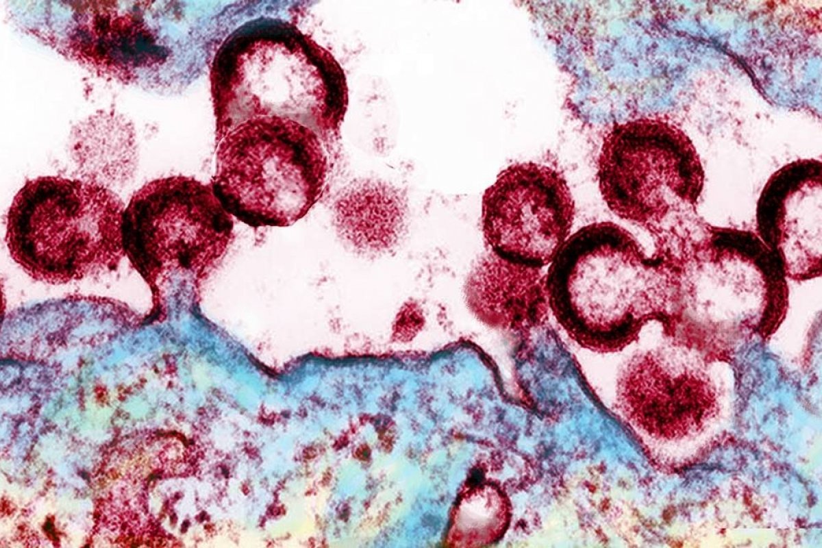 Cientistas usarão nova técnica para eliminar HIV totalmente do corpo