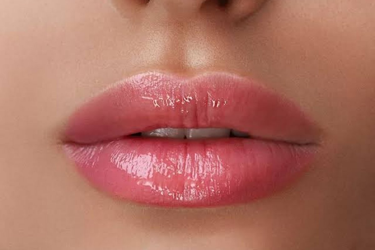 Preenchimento labial: tudo que você precisa saber antes de realizar essa técnica tão famosa e popular! 