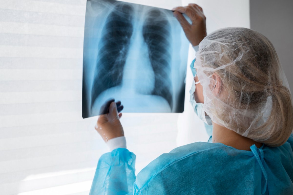 Aumento de casos de pneumonia atípica preocupa hospitais em São Paulo e levanta alerta no país